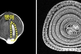 Південнокорейські вчені прогнозують якість зберігання цибулі за допомогою МРТ 